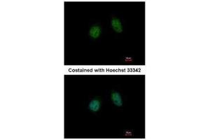 ICC/IF Image Immunofluorescence analysis of paraformaldehyde-fixed HeLa, using Annexin V, antibody at 1:500 dilution. (Annexin V anticorps)