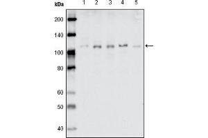 Western blot analysis using EhpB1 mouse mAb against MDA-MB-468 (1), MDA-MB-453 (2), MCF-7 (3), T47D (4) and SKBR-3 (5) cell lysate. (EhpB1 (AA 19-133) anticorps)