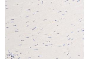 ABIN6267284 at 1/100 staining human heart tissue sections by IHC-P.