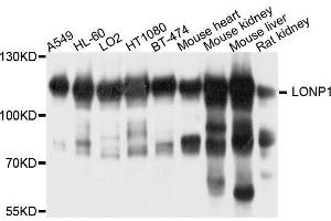 Western blot analysis of extracts of various cell lines, using LONP1 antibody. (LONP1 anticorps  (AA 120-400))