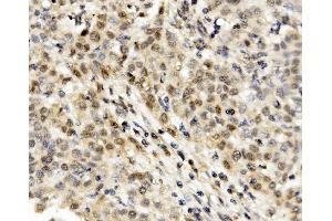 IHC analysis of MNT using anti-MNT antibody (ABIN7601555). (MNT anticorps  (AA 381-564))