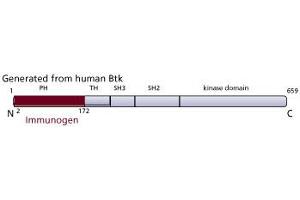Image no. 2 for anti-Bruton Agammaglobulinemia tyrosine Kinase (BTK) (AA 2-172), (N-Term) antibody (ABIN968375) (BTK anticorps  (N-Term))