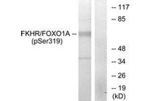 Western blot analysis of extracts from HeLa cells treated with EGF, using FKHR (Phospho-Ser319) Antibody. (FOXO1 anticorps  (pSer319))