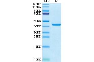 Protein Kinase A (PKA) (AA 2-350) protein (His tag)
