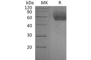 Western Blotting (WB) image for Interleukin 1 Receptor-Like 1 (IL1RL1) protein (His tag) (ABIN7320553)