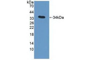 Detection of Recombinant APOC3, Human using Polyclonal Antibody to Apolipoprotein C3 (APOC3) (APOC3 anticorps  (AA 21-99))