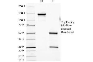 SDS-PAGE Analysis Purified CD6 Mouse Monoclonal Antibody (SPV-L14). (CD6 anticorps)