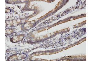 Immunoperoxidase of monoclonal antibody to TIMM9 on formalin-fixed paraffin-embedded human small Intestine.