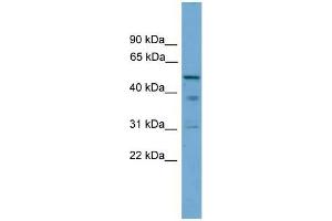 Human PANC1; WB Suggested Anti-TINAG Antibody Titration: 0.
