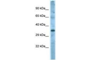 Image no. 1 for anti-Fas Ligand (TNF Superfamily, Member 6) (FASL) (AA 121-170) antibody (ABIN6748197) (FASL anticorps  (AA 121-170))