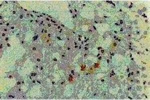 Immunohistochemistry (IHC) image for anti-Hepatitis C Virus Core Protein (HCV C) (AA 13-124), (AA 369-704) antibody (FITC) (ABIN2451998)