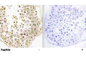 Immunohistochemistry analysis of paraffin-embedded human testis tissue, using SPZ1 polyclonal antibody . (SPZ1 anticorps)