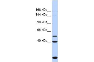 Host:  Rabbit  Target Name:  PSD3  Sample Type:  Fetal Heart lysates  Antibody Dilution:  1. (PSD3 anticorps  (C-Term))