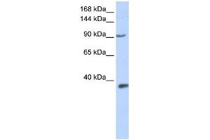WB Suggested Anti-EPAS1 Antibody Titration:  0. (EPAS1 anticorps  (Middle Region))