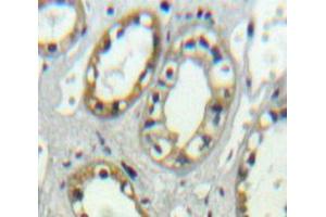 Used in DAB staining on fromalin fixed paraffin-embedded kidney tissue (PLVAP anticorps  (AA 123-393))