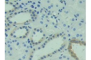 Detection of CAPS in Human Kidney Tissue using Polyclonal Antibody to Calcyphosine (CAPS)
