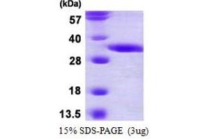 SDS-PAGE (SDS) image for 2,4-Dienoyl CoA Reductase 2, Peroxisomal (DECR2) (AA 1-292) protein (His tag) (ABIN667629)
