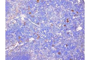 IHC analysis of CD229 using anti-CD229 antibody (ABIN6719290). (LY9 anticorps)