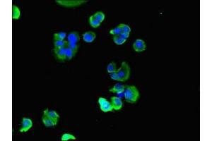Immunofluorescent analysis of MCF-7 cells using ABIN7160555 at dilution of 1:100 and Alexa Fluor 488-congugated AffiniPure Goat Anti-Rabbit IgG(H+L)
