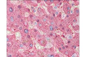 Immunohistochemistry of Goat Anti-Fibrinogen antibody.
