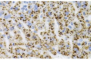 Immunohistochemistry of paraffin-embedded Rat liver using NTRK1 Polyclonal Antibody at dilution of 1:100 (40x lens). (TRKA anticorps)