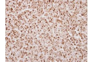 IHC-P Image Immunohistochemical analysis of paraffin-embedded BT483 xenograft, using UHRF1, antibody at 1:250 dilution.