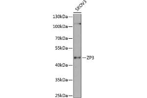 Western blot analysis of extracts of SKOV3 cells, using ZP3 antibody (ABIN6130818, ABIN6150537, ABIN6150539 and ABIN6224382) at 1:1000 dilution.