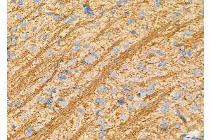 ABIN6263324 and ABIN6277538 at 1/100 staining Rat brain tissue by IHC-P. (MOG anticorps  (C-Term))
