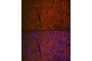 Immunofluorescence analysis of mouse heart using F Rabbit mAb (ABIN7267152) at dilution of 1:100 (40x lens).