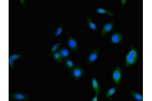 Immunofluorescence staining of Hela cells with ABIN7142208 at 1:333, counter-stained with DAPI. (PSMD2 anticorps  (Regulatory Subunit 2))