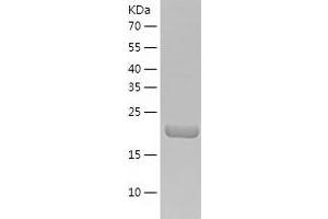 Western Blotting (WB) image for Ethylmalonic Encephalopathy 1 (ETHE1) (AA 13-254) protein (His-IF2DI Tag) (ABIN7122823)
