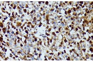 Immunohistochemistry of paraffin-embedded Human appendix using DUT Polyclonal Antibody at dilution of 1:100 (40x lens).