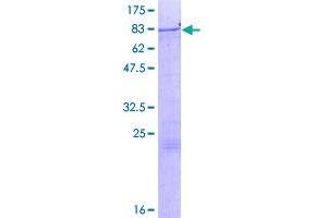 Image no. 1 for Zinc Finger Protein 85 (ZNF85) (AA 1-536) protein (GST tag) (ABIN1326469)