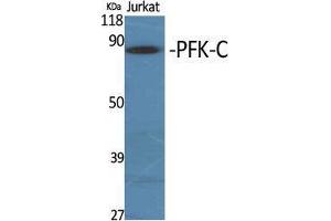Western Blot (WB) analysis of specific cells using PFK-C Polyclonal Antibody. (PFKP anticorps  (Internal Region))