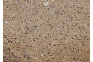 ABIN6273061 at 1/100 staining Rat brain tissue by IHC-P.