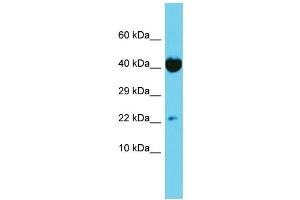 Host: Rabbit Target Name: TRAPPC6A Sample Type: HT1080 Whole Cell lysates Antibody Dilution: 1. (TRAPPC6A anticorps  (N-Term))