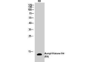 Western Blotting (WB) image for anti-Histone H4 (acLys8) antibody (ABIN3181871) (Histone H4 anticorps  (acLys8))