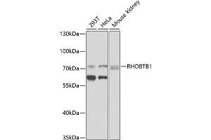 Western blot analysis of extracts of various cell lines, using RHOBTB1 antibody (ABIN6128679, ABIN6146936, ABIN6146937 and ABIN6225297) at 1:1000 dilution. (RHOBTB1 anticorps  (AA 240-400))