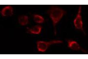 ABIN6269323 staining HeLa cells by IF/ICC. (LIPE anticorps  (Internal Region))