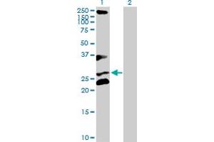 Western Blot analysis of RCHY1 expression in transfected 293T cell line by RCHY1 MaxPab polyclonal antibody.