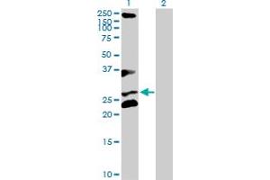 Western Blot analysis of RCHY1 expression in transfected 293T cell line by RCHY1 MaxPab polyclonal antibody. (RCHY1 anticorps  (AA 1-252))