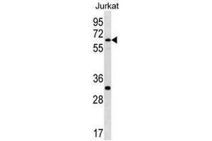 SMARCD1 Antibody (C-term) western blot analysis in Jurkat cell line lysates (35µg/lane). (SMARCD1 anticorps  (C-Term))