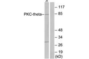 Western blot analysis of extracts from Jurkat cells, treated with PMA 200nM 30', using PKC thet (Ab-676) Antibody. (PKC theta anticorps  (AA 643-692))