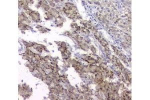 IHC analysis of TIMM17A using anti-TIMM17A antibody (ABIN6719637).