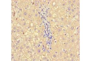 Immunohistochemistry of paraffin-embedded human liver tissue using ABIN7143790 at dilution of 1:100 (alpha 2 Macroglobulin anticorps  (AA 1216-1467))