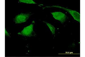 Immunofluorescence of monoclonal antibody to DAZAP2 on HeLa cell. (DAZAP2 anticorps  (AA 93-168))