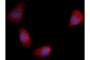 Immunofluorescence (IF) image for anti-Fibroblast Growth Factor 12 (FGF12) (AA 1-181) antibody (PE) (ABIN5565468) (FGF12 anticorps  (AA 1-181) (PE))