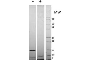 SDS-PAGE of Mouse Resistin Dimer Recombinant Protein SDS-PAGE of Mouse Resistin Dimer Recombinant Protein.