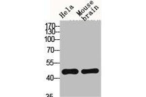 Western Blot analysis of HELA MOUSE-BRAIN cells using Fusin Polyclonal Antibody (CXCR4 anticorps  (C-Term))