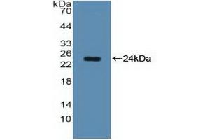 WB of Protein Standard: different control antibodies against Highly purified E.